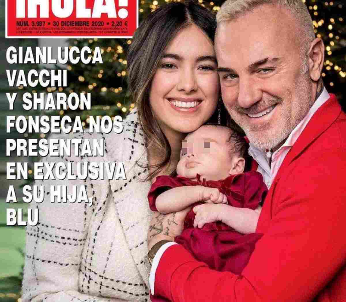 Gianluca Vacchi presenta la figlia malformazione palato