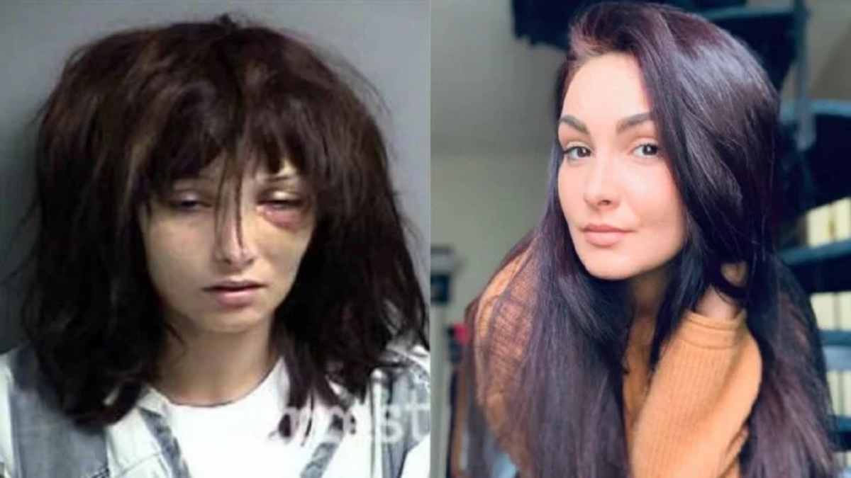 Madison McManus prima e dopo la dipendenza