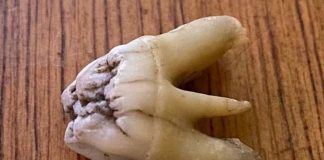 dente tesco