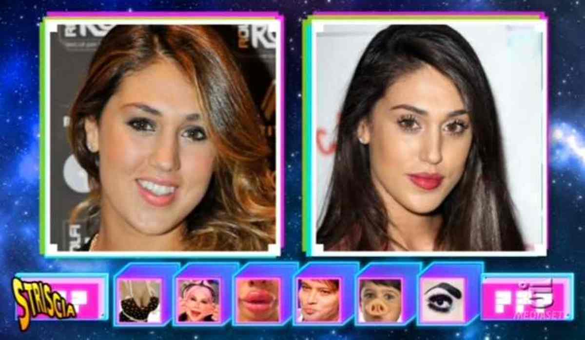 chirurgia-estetica-cecilia-rodriguez