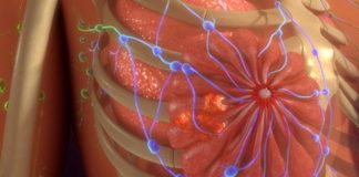 cancro acido palmitico