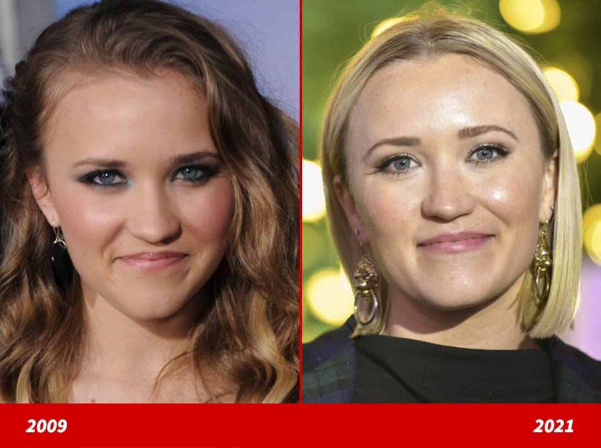 Emily Osment plastic surgery