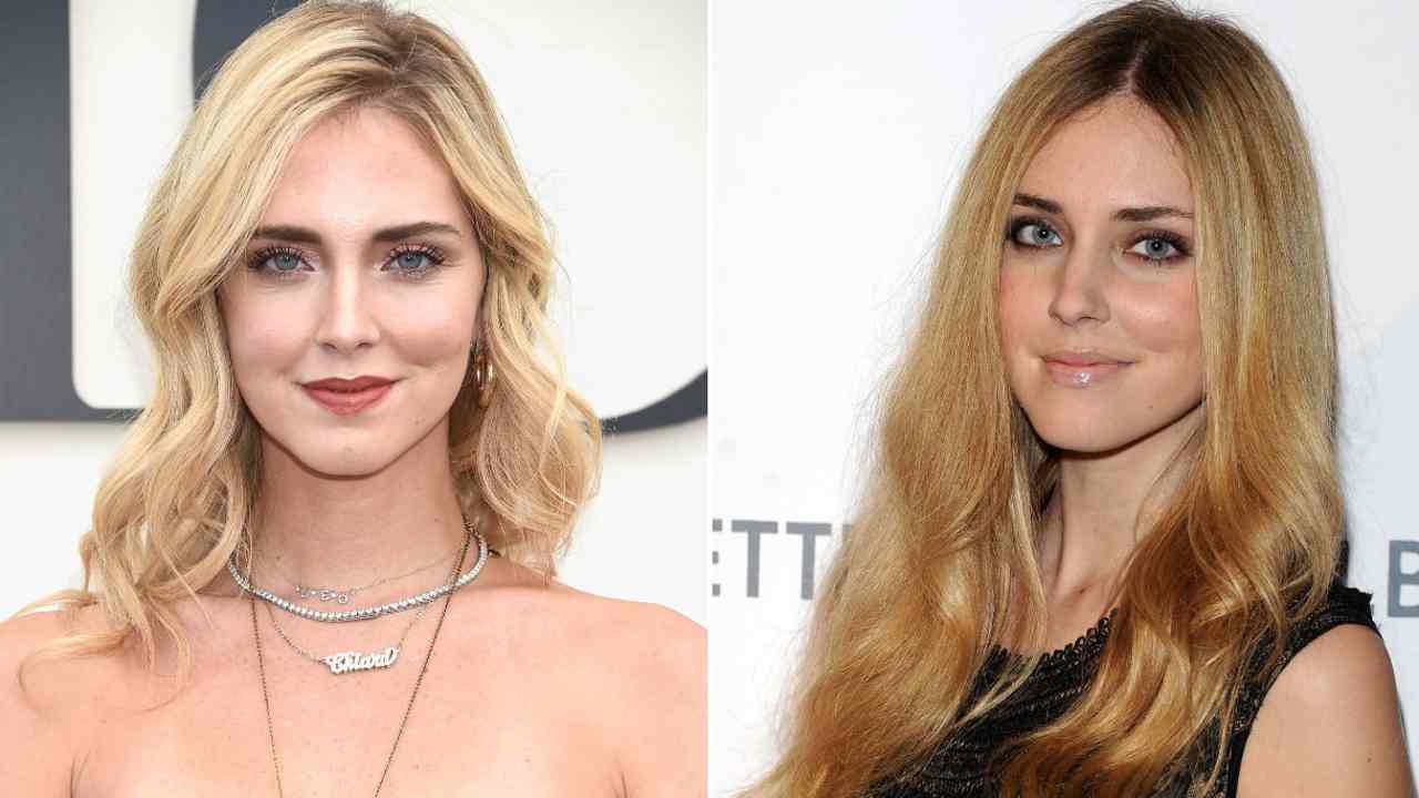 Ferragni chirurgia estetica