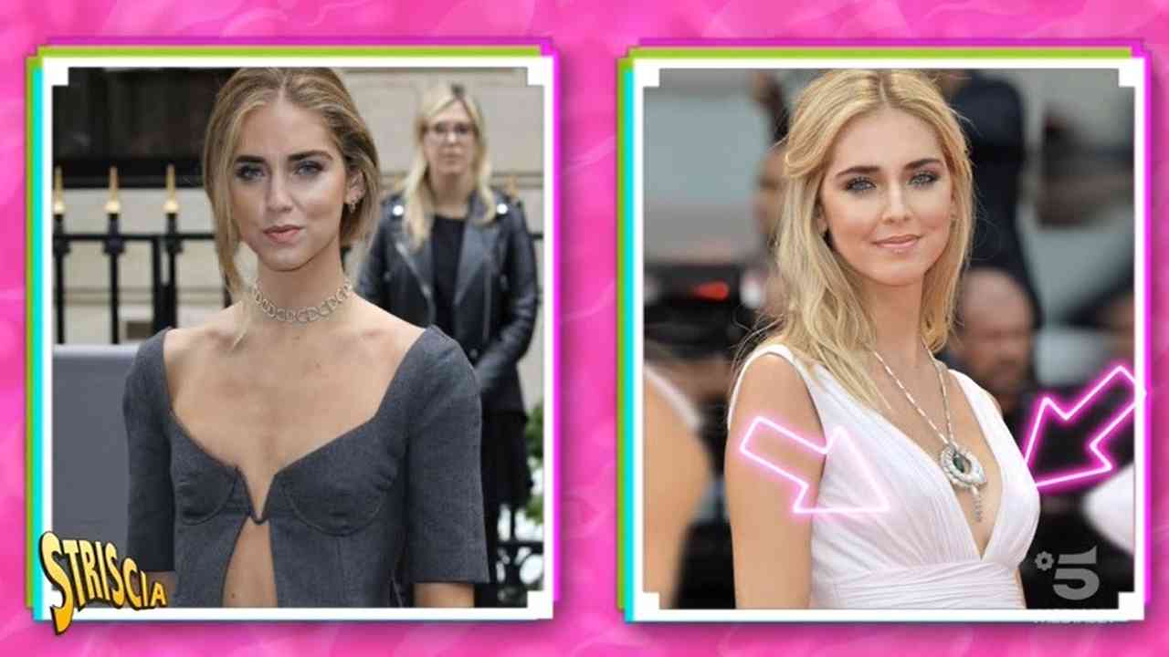 Ferragni chirurgia estetica