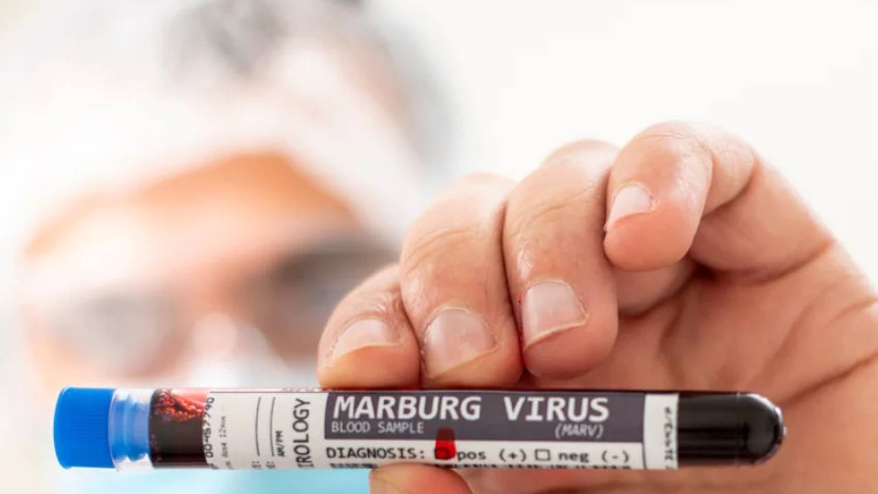 virus marburg 